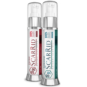 bottles of Scarrid Natural Scar Formula