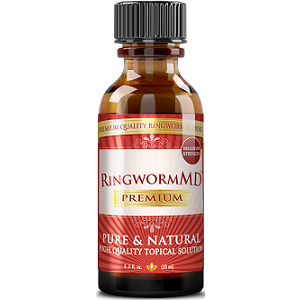 RingwormMD Premium for Ringworm